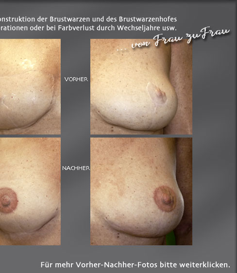 permanent make up brust areola scalp haar